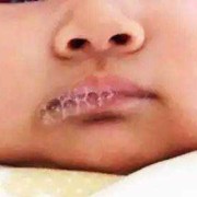 宝宝会吐泡泡，感觉喉咙有痰，有事吗,胎儿吐泡泡是什么感觉啊