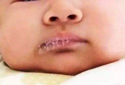 宝宝会吐泡泡，感觉喉咙有痰，有事吗,胎儿吐泡泡是什么感觉啊