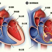 胎儿室间隔多少正常（胎儿室间隔多少正常）