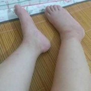 孕妇脚酸,孕期眼酸是怎么回事