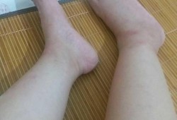 孕妇脚酸,孕期眼酸是怎么回事