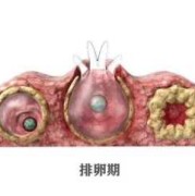 什么是黄体破裂,孕期黄体破裂是怎么回事