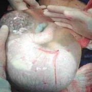 胎儿吞咽羊水孕妇感觉（胎儿吞咽羊水孕妇感觉）