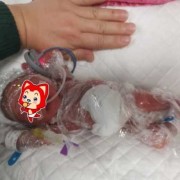 孕30周胎儿发育情况是什么,怀孕30周胎儿图片真人