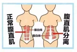 孕期腹直肌（孕期腹直肌的变化图片）