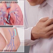 孕期肺栓塞（肺栓塞能治好吗？肺栓塞应该怎么治疗呢？会不会很严重呢）