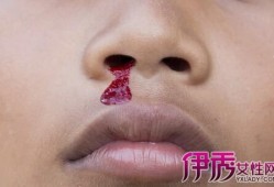 孕期鼻子流血怎么回事（孕期鼻子流血怎么回事儿）