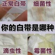孕期白带发黄正常吗（怀孕初期白带发黄怎么办）