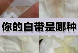 孕期白带发黄正常吗（怀孕初期白带发黄怎么办）