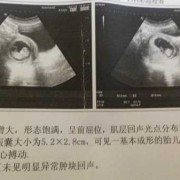 正常胎儿后（70天的宝宝平时正常的表现有哪些）