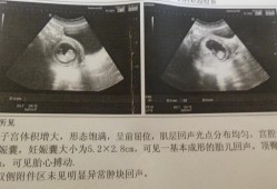 正常胎儿后（70天的宝宝平时正常的表现有哪些）