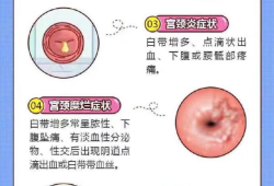 孕妇阴道炎影响胎儿吗