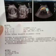 孕39周,胎盘2级加可以催产吗,胎儿2级加多久会生