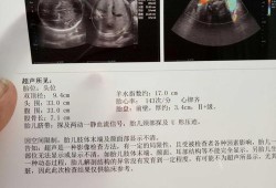 孕39周,胎盘2级加可以催产吗,胎儿2级加多久会生