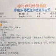 胎儿头围发育（怀孕3个月胎儿头臀长是多少）
