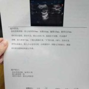 胎儿彩超检查（胎儿彩超检查多少钱一次）