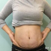 孕期肚子长纹（孕期肚子长纹怎么控制）