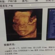八个月胎儿彩超（八个月胎儿彩超图真实图）