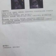 朋友怀孕去产检，查出胎儿肾积水，正常值是多少啊,胎儿有积水是什么意思