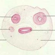胎儿脐血管（新生儿脐带的结构是）