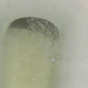 怀孕期间白带发黄对宝宝有影响吗,孕妇尿完尿一擦黄绿色分泌物