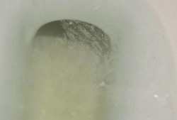 怀孕期间白带发黄对宝宝有影响吗,孕妇尿完尿一擦黄绿色分泌物