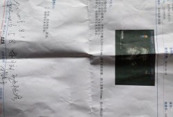血流信号是胎儿的什么（血流信号是胎儿的什么部位）