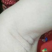 孕期腋窝变黑怎么回事（怀孕腋下变黑怎么办）