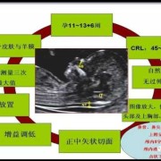 怎样让胎儿动起来（做nt怎样让胎儿动起来）
