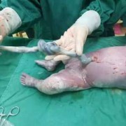 胎儿什么时候有脐带（宝宝脐带什么时候脱落呢？一般情况下脐带什么时候脱落呢）