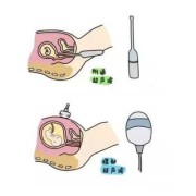 孕期做b超要空腹吗（做妇科b超需要空腹吗）