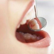 请问一下孕妇可不可以去补牙齿的呢,孕期可以补牙吗?之前补的掉了
