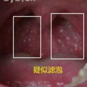 咽炎对胎儿有影响吗（孕妇咽炎对胎儿有影响吗）