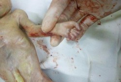 怀孕25周胎儿图（怀孕25周突然胎动频繁是什么原因）