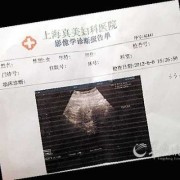 怀孕天数怎么算的？B超可以检测出，怀孕的天数吗,胎儿周期计算表