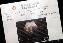 怀孕天数怎么算的？B超可以检测出，怀孕的天数吗,胎儿周期计算表