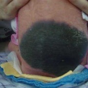 怀孕9周，能打掉吗，还能在生育吗,9周胎儿流产图片真实