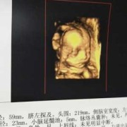 5个月胎儿彩超（5个月胎儿彩超图片）