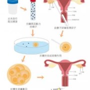 胎儿着床是什么时候（试管婴儿移植几天着床）