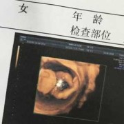 4个月大的胎儿（4个月宝宝可以坐着吗？宝宝多大可以坐）