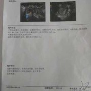 孕6周，查说宫腔积血，要注意啥,子宫有积血会影响胎儿发育正常吗