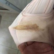 孕期出血颜色（预产期见红是什么颜色的血?血量是多少）