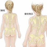 畸形胎儿能要吗（半椎体畸形胎儿能要吗）