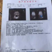 胎儿膀胱囊肿（胎儿膀胱囊肿生下来有问题吗?）