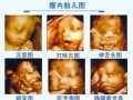请问下大家孕期做大排畸好还是四维好,胎儿大排畸是检查什么项目