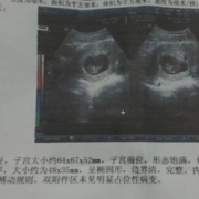 34周胎儿双顶径标准是多少34周胎儿双顶径过大怎么办,34周胎儿b超图片大全
