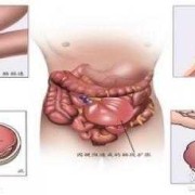 胎儿消化道梗阻（胎儿消化道梗阻可生下来吗）