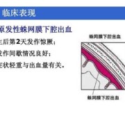 胎儿颅内出血原因（胎儿颅内出血原因有哪些）