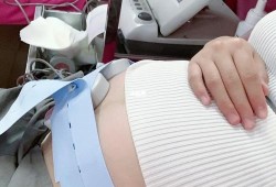 胎儿心率偏快怎么办（做胎心监护宝宝老动一动心率就快正常么）