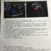怀孕24周胎儿彩超图（怀孕24周四维彩超左心室有两个强回声点怎么办）